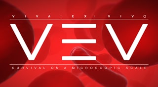 VEV: VIVA EX VIVO